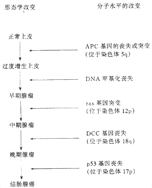 结直肠癌通过上皮增生－腺瘤－癌的阶梯性的演进的分子生物学和形态学改变的关系