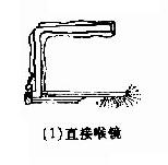 直接喉镜检查法