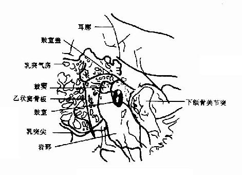 乳突岩部轴位