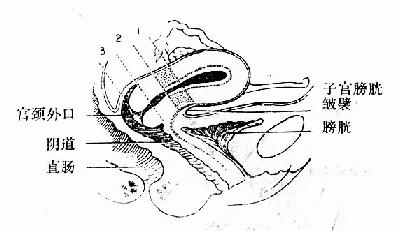 子宫矢状剖面图，示峡部