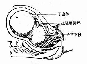 软产道在临产后的变化