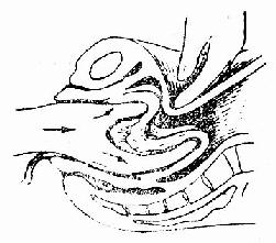 内翻子宫复位示意图