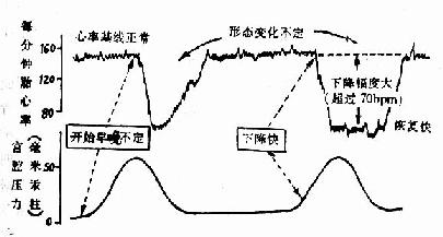 PFHR 变异减速