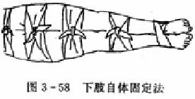  下肢自体固定法