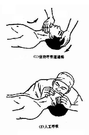 人工呼吸法