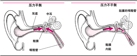 中耳内的压力