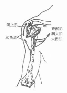 肱骨外科颈骨折