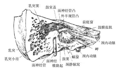 鼓室内侧壁