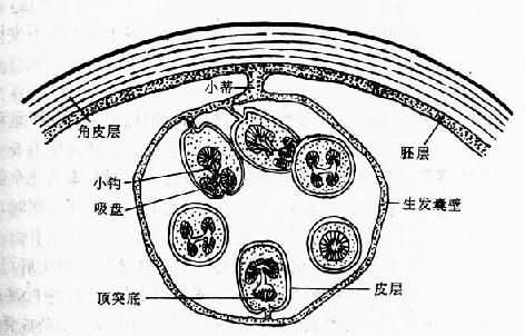 棘球蚴及生发囊模式图（仿Morseth）