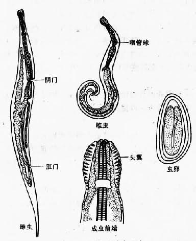 蛲虫成虫与虫卵