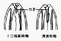 两种钩虫丝状蚴的前端