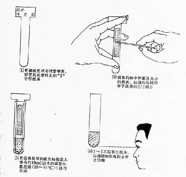 钩蚴培养法