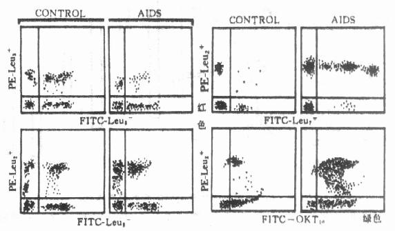 健康人艾滋病人淋巴细胞表面抗原的比较 