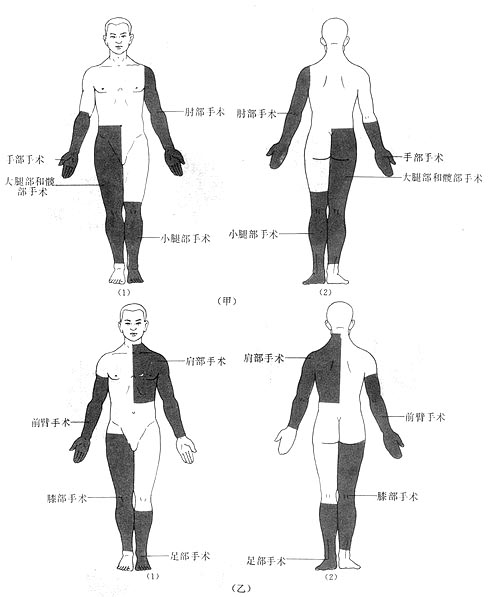 四肢手术