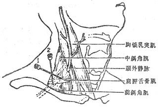 锁骨上肌间沟解剖