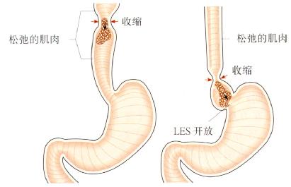 食团沿食管向下推进