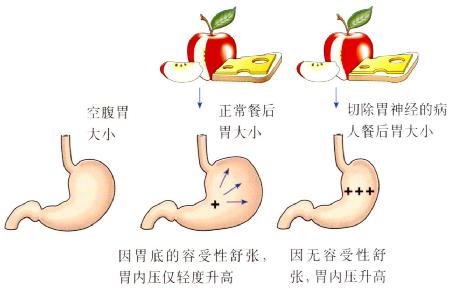 容受性舒张差导致胃内压升高