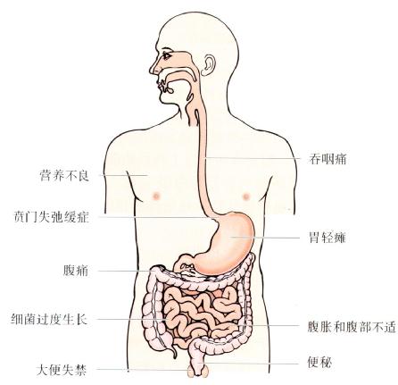 慢性假性肠梗阻