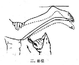 卧位膝腱反射检查