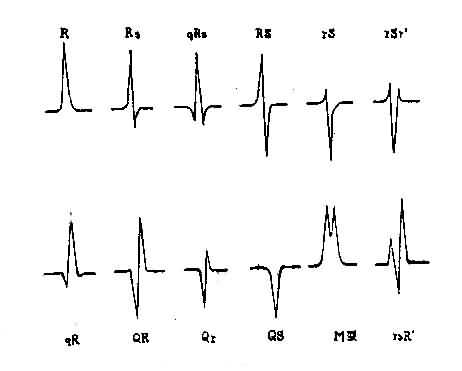 QRS波群的命名