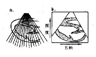 切面超声心动图示意图