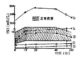 TRH兴奋试验反应曲线