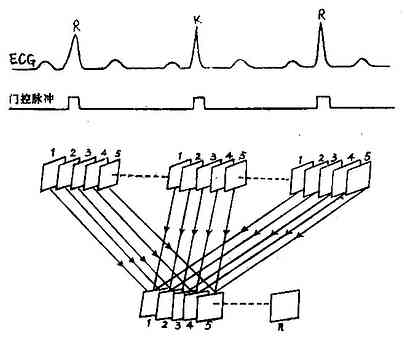 心电门控帧模式数据采集示意图