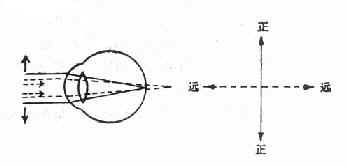 单纯远视散光