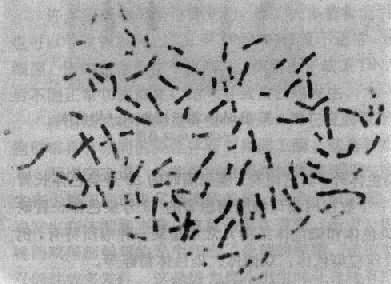 一个癌细胞的染色体共104条，包括许多异常的染色体