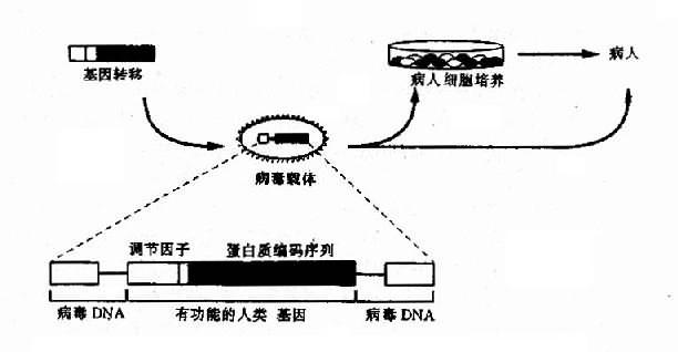 人的外源基因包装在缺陷型反转录病毒中感染细胞