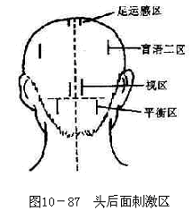 头后面刺激区